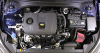 AEM C.A.S. 19-20 Kia Forte 2.0L F/I Cold Air Intake